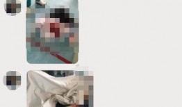 医生爆料透析病人视频,揭秘透析过程中的心酸与希望